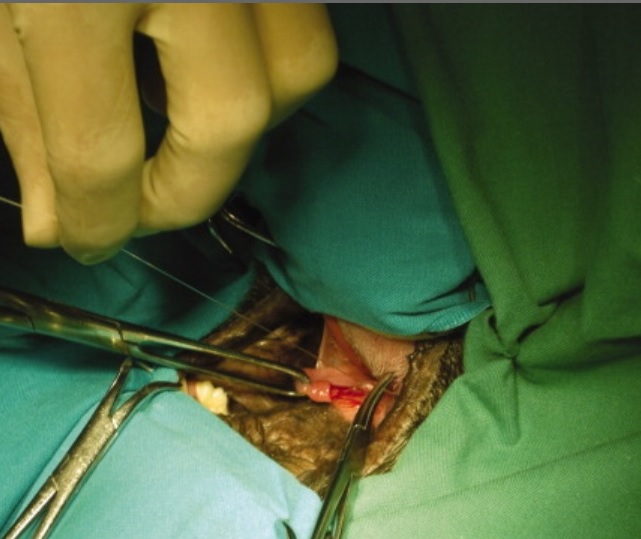 cirurgia palato mole