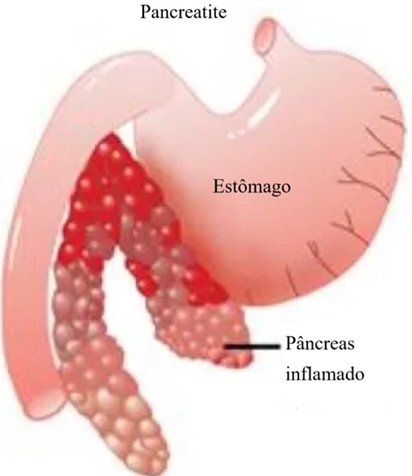 Pancreatite Canina