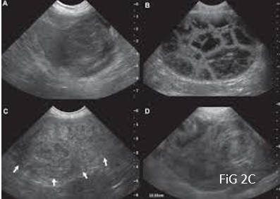eco hemagiossarcoma